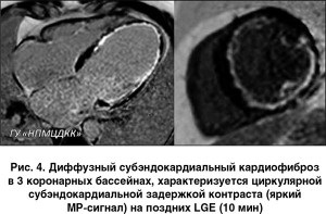 Магнітно-резонансна томографія і її діагностичні можливості в кардіології