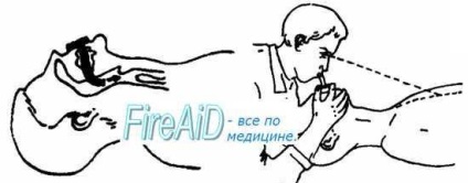 Metoda de prim ajutor - atac de cord (infarct miocardic) - cărți 