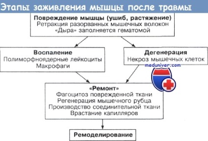 Mecanisme de vindecare musculară după traumă