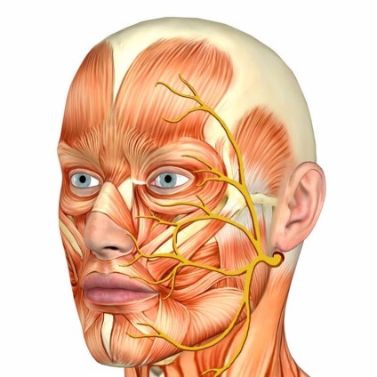 Nevralgia nervului trigeminal