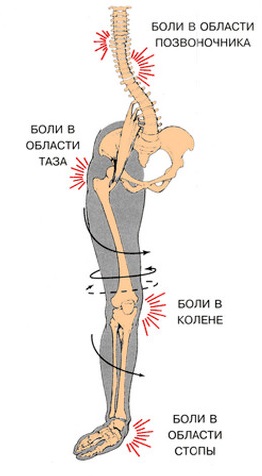 Operațiile pe picior (chirurgia estetică a piciorului) din Rostov pe deformarea Don, valgus,