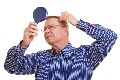 Miért fejfájás hajhullás okoz emberekben a kopaszodást?