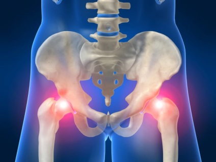 Poliartrita articulației genunchiului și a umărului - simptome și tratament