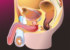 Consecințele varicocelei și prevenirea complicațiilor după intervenție chirurgicală