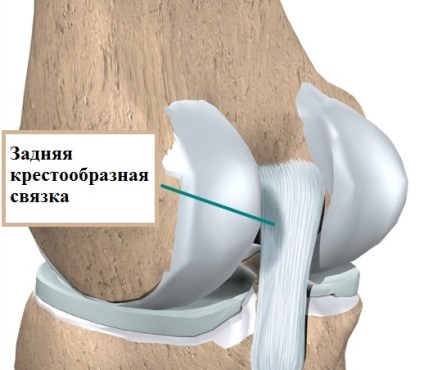 Daune și rupturi ale ligamentului posterior al crucii