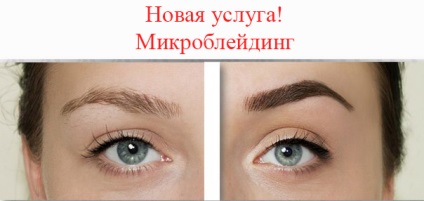 Aspectul centrului cu discount cu laser, Kiev