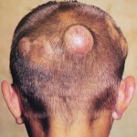 Cauzele subțierea părului