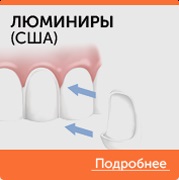 Proteze pentru boala parodontală