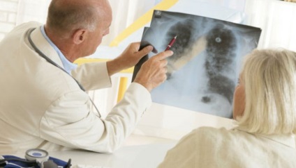 Cancerul pulmonar, dacă este posibil să se vindece