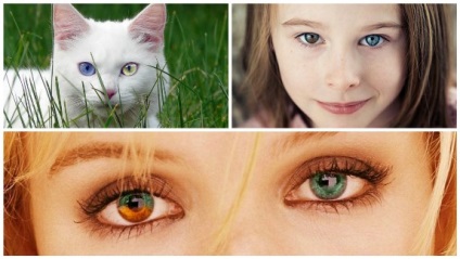 Ochii diferiți (culori diferite) la nou-născuți și oameni de altă vârstă
