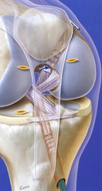 Ruperea ligamentului (ligamentelor) cruciat posterior