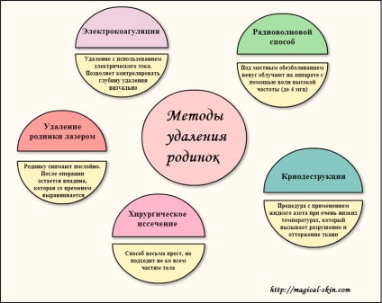 Semne de naștere pe trasaturile ochiului sau ale pleoapelor, tratamentul, îndepărtarea