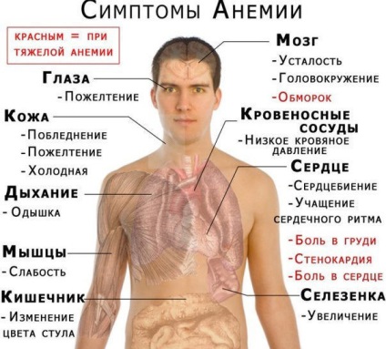 Симптоми на остра пиелонефрит, лечение и симптоми