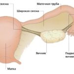 Sistem de interogare a pacienților ginecologici, ginecologie