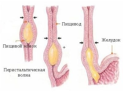 Spasmul cauzat de esofag, diagnostic, tratament