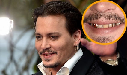 Zâmbetul lui Johnny Depp pare teribil.