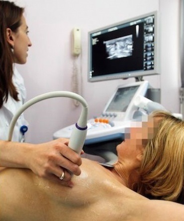 Mell ultrahang, mammográfia