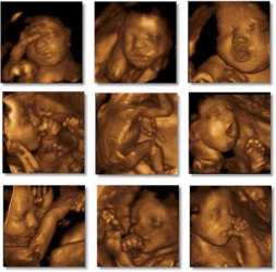 Uzi fetus 3d care va arăta