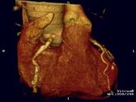 Posibilități de imagistică prin rezonanță magnetică și tomografie computerizată (MRT și CT) în diagnosticarea bolilor