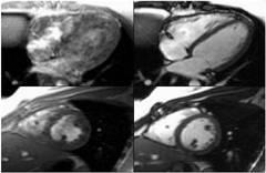 Posibilități de imagistică prin rezonanță magnetică și tomografie computerizată (MRT și CT) în diagnosticarea bolilor