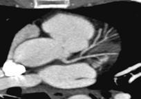 Posibilități de imagistică prin rezonanță magnetică și tomografie computerizată (MRT și CT) în diagnosticarea bolilor