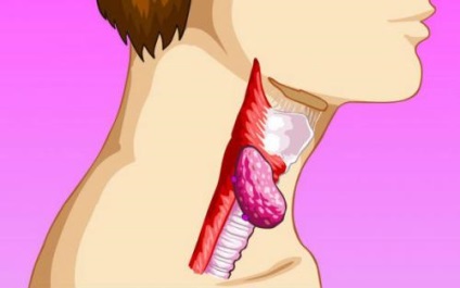 Arderea în gât și esofag, gură și stern, cauzează în tiroidă