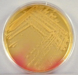 Staphylococcus aureus provoacă apariția bolii la adulți, cauze de infecție în gât și în