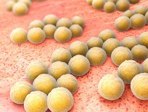 Staphylococcus aureus provoacă apariția bolii la adulți, cauze de infecție în gât și în