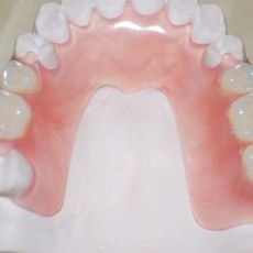Proteze dentare din polipropilena blackjacks Zhytomyr