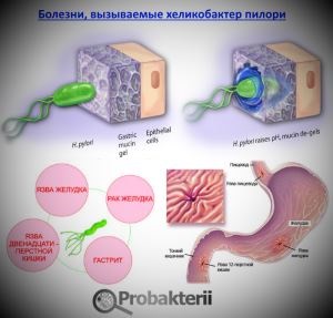 Bacteriile din corpul nostru sunt utile și distructive, greutatea totală, așa cum apar și se înmulțește,