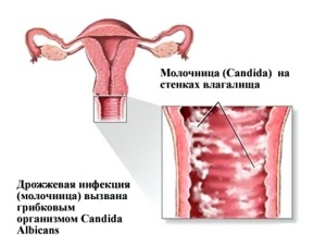 Ce inseamna mancarimi si buze arzatoare