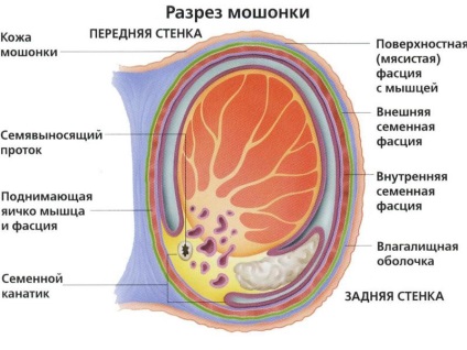 Care este picatura scrotului la bărbați semne de testicul hidrocelcel, simptome ale bolii, tratament și fotografii