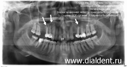 Imagine panoramică digitală a dinților