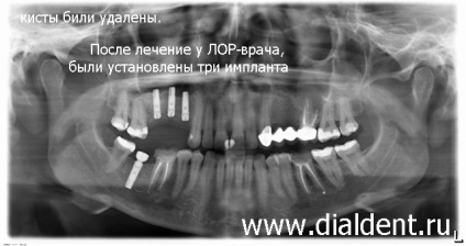 Digitális panorámakép a fogakról