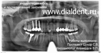 Digitális panorámakép a fogakról
