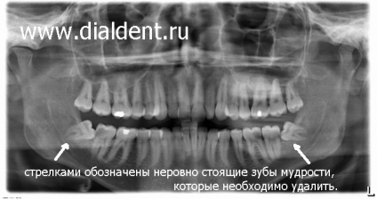 Digitális panorámakép a fogakról