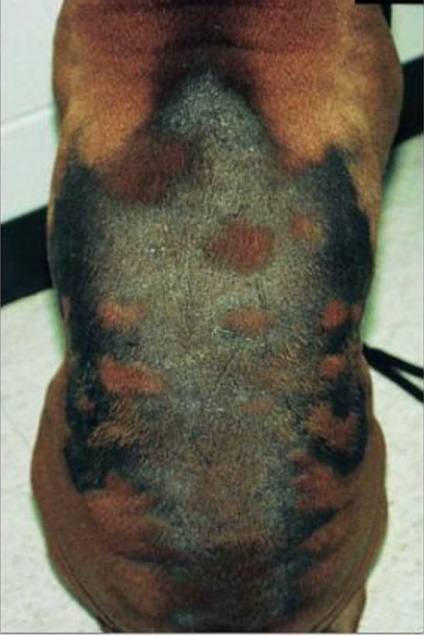 Alopecia ciclică a trunchiului de câini (alopecie sezonieră a trunchiului), medic veterinar