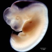 Embrion 6 săptămâni