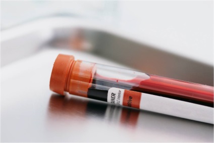 Hemoglobina în sângele câinilor și pisicilor - un test de sânge la pisici și câini de la Moscova