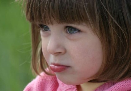 A herpesz a gyermekeknél - egy egyszerű hideg a suzsik ajkán