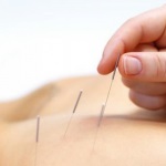 Acupunctura pentru pierderea in greutate