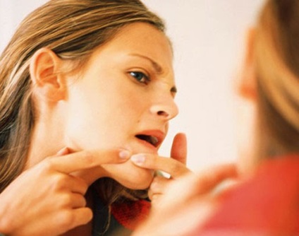 Cum să eliminați rapid acneea de pe față timp de o zi la domiciliu, îngrijirea pielii cu probleme