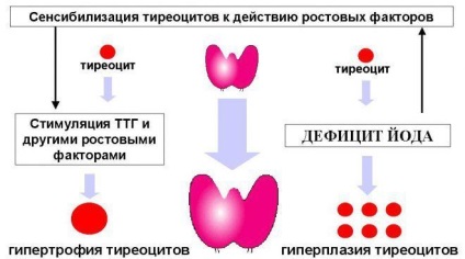 Chistul glandei tiroide - cod pentru μb-10