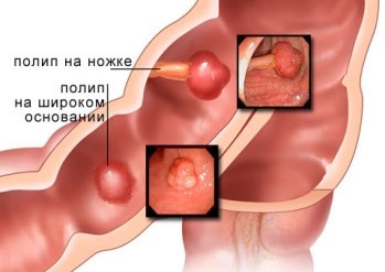 Clinica de Medicină Tibetană »- centrul medical din Kazan