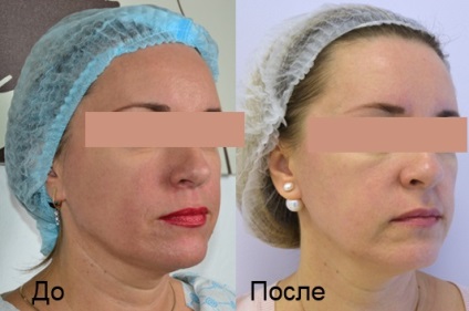 Clinica cosmetică a alinei Bukharova