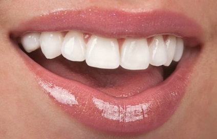Fotografiile frumoase ale dinților și secretele unor zâmbete frumoase