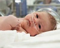 Hemoragie la nivelul creierului la nou-născuți, consecințe, simptome și cauze
