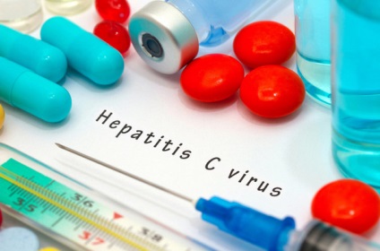 Tratamentul hepatitei C, medicamente antivirale eficiente