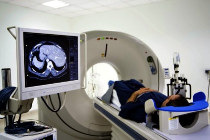 Terapia radiologică (iradiere) cu prețul glioblastomului, consecințe, principii
