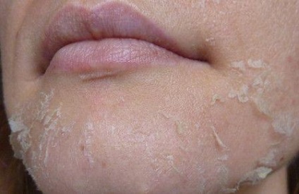 Masca de pe pielea peeling pe fata, retete si recenzii, ajutor de ierburi si uleiuri, remedii folclorice